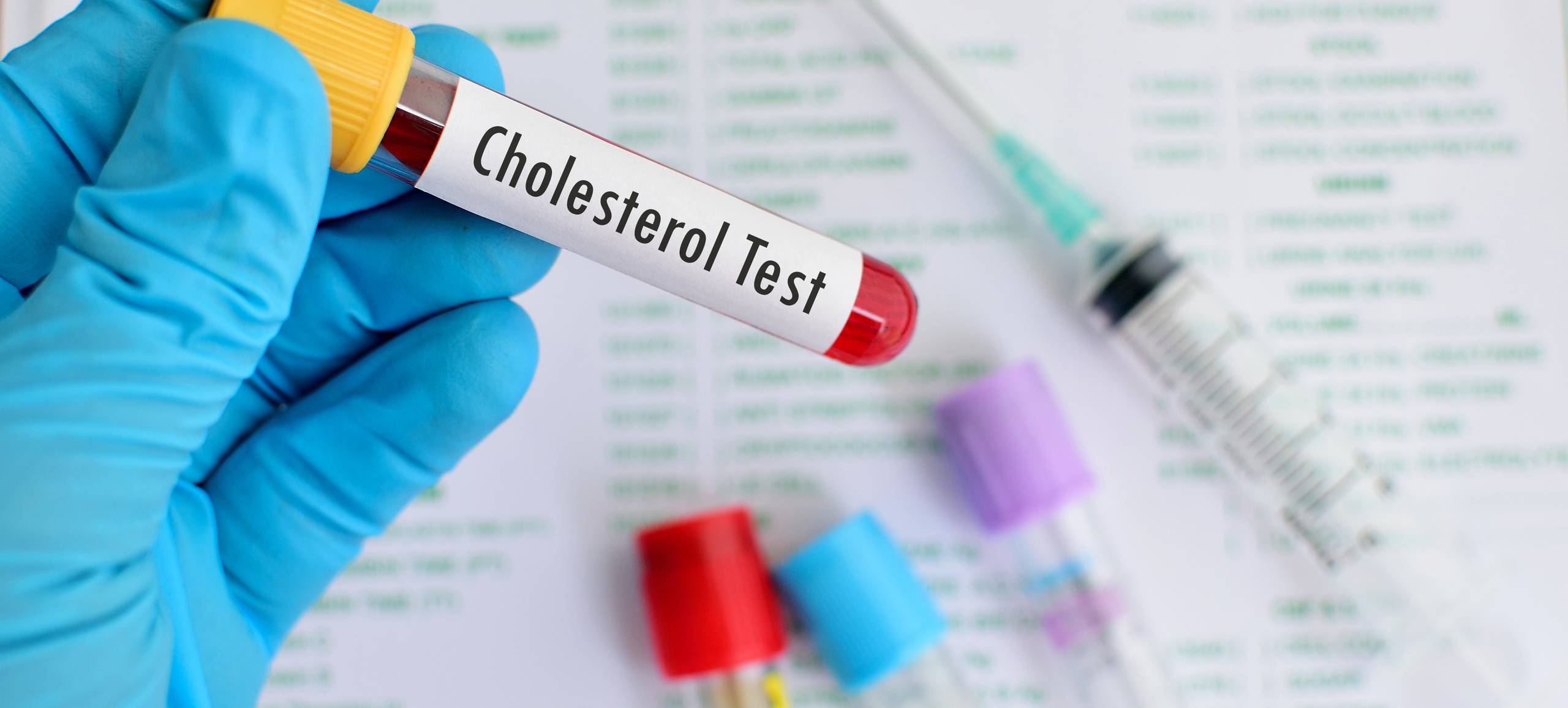 Ostrożnie z obniżaniem cholesterolu u diabetyków!