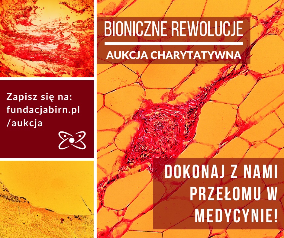 Aukcja charytatywna “Bioniczne rewolucje” już 12 marca!
