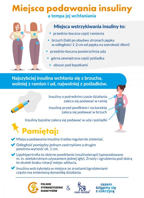 4miejsca Podawania Insuliny 09092021 Polskie Stowarzyszenie Diabetyków 0552